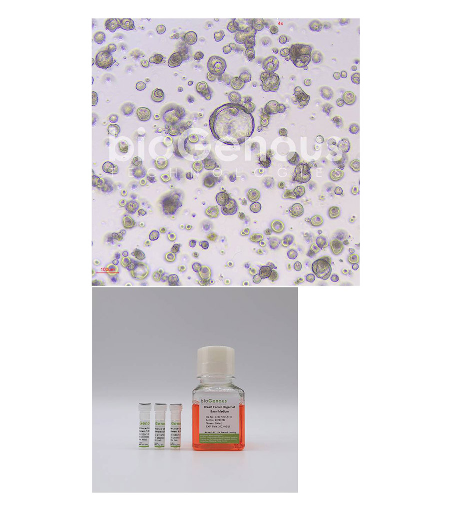 Breast Cancer Organoid Kit乳腺癌