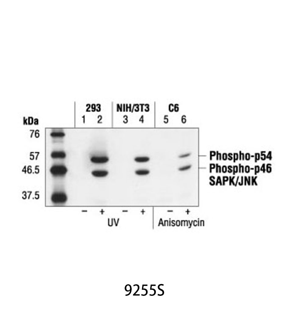 Phospho-SAPK/JNK (Thr183/Tyr185) (G9) Mouse mAb