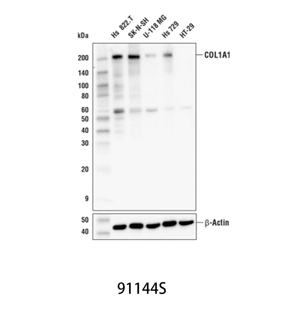 COL1A1 (E8I9Z) Rabbit mAb