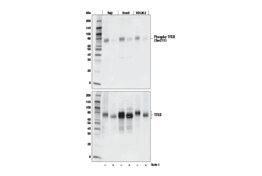 Phospho-TFEB (Ser211) (E9S8N) Rabbit mAb