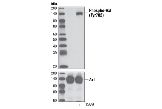 Phospho-Axl (Tyr702) (D12B2) Rabbit mAb