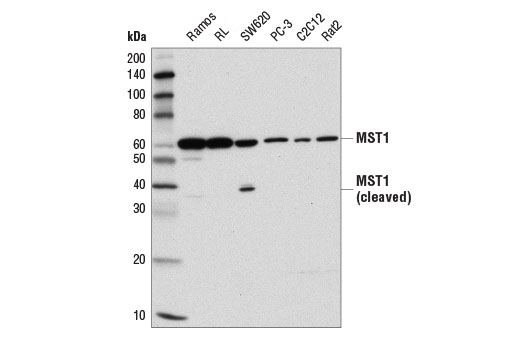 MST1 (D8B9Q) Rabbit mAb