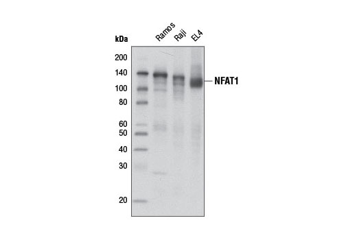 NFAT1 (D43B1) XP Rabbit mAb