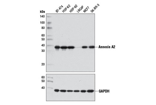 Annexin A2 (D11G2) Rabbit mAb