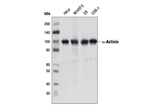 α-Actinin (D6F6) XP Rabbit mAb