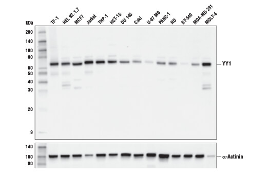 YY1 (D3D4Q) Rabbit mAb