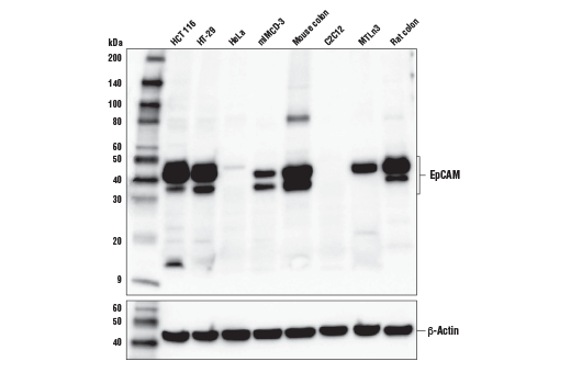 EpCAM (E6V8Y) XP Rabbit mAb (Mouse Preferred)