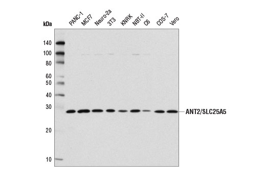 ANT2/SLC25A5 (E2B9D) Rabbit mAb