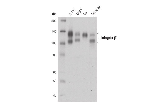 Integrin β1 (D6S1W) Rabbit mAb