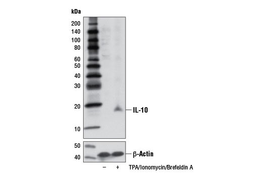 IL-10 (D13A11) XP Rabbit mAb