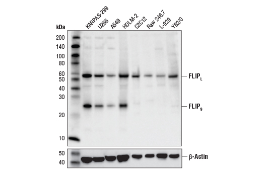 FLIP (D5J1E) Rabbit mAb