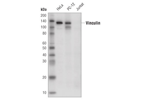 Vinculin (E1E9V) XP Rabbit mAb (HRP Conjugate)