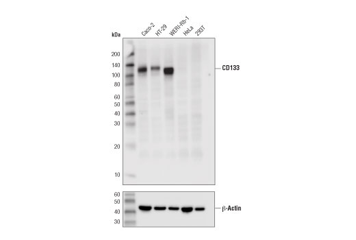 CD133 (D4W4N) XP Rabbit mAb
