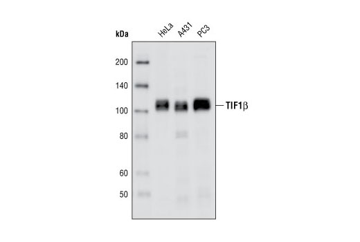 KAP-1 Antibody