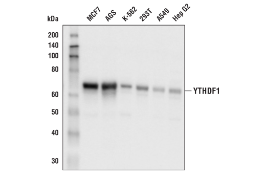 YTHDF1 Antibody