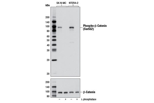 Phospho-β-Catenin (Ser552) (D8E11) Rabbit mAb