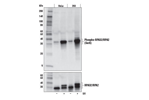 Phospho-RPA32/RPA2 (Ser8) (E5A2F) Rabbit mAb
