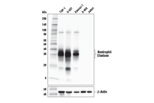 Neutrophil Elastase (E9C9L) XP Rabbit mAb