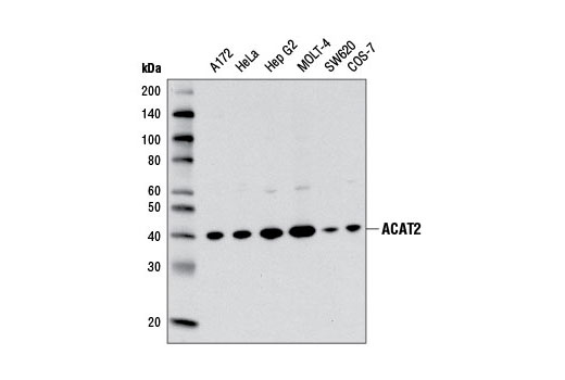 ACAT2 (E1L8V) Rabbit mAb