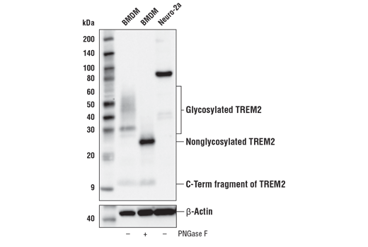 TREM2 (E7P8J) Rabbit mAb (Carboxy-terminal Antigen Mouse Specific)