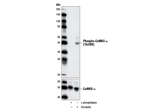 PhosphoPlusCaMKII (Thr286) Antibody Duet