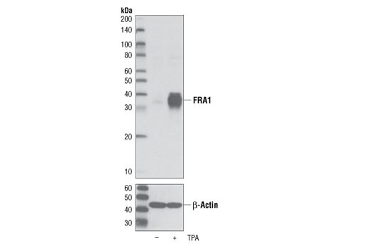 FRA1 (D80B4) Rabbit mAb