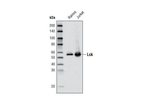 Lck (D88) XP Rabbit mAb