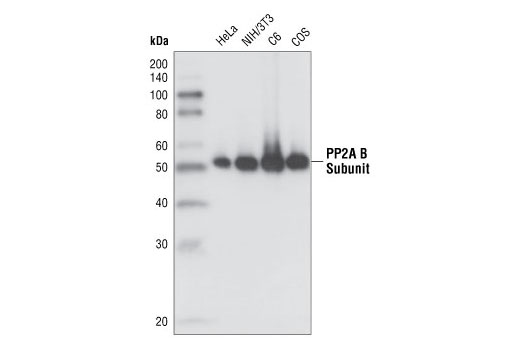 PP2A B Subunit (100C1) Rabbit mAb