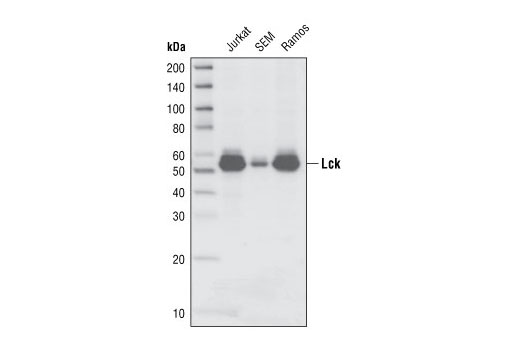 Lck (L22B1) Mouse mAb