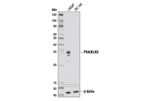 PSA/KLK3 (D2A8) Rabbit mAb