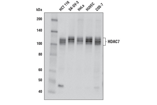 HDAC7 (E7O8V) Rabbit mAb