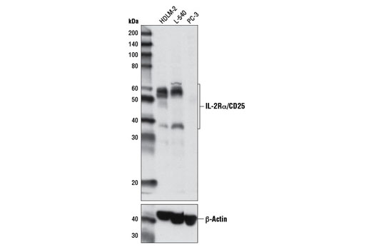 IL-2Rα/CD25 (D6K5F) Rabbit mAb