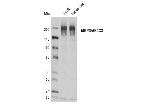 MRP3/ABCC3 (D1W1P) Rabbit mAb