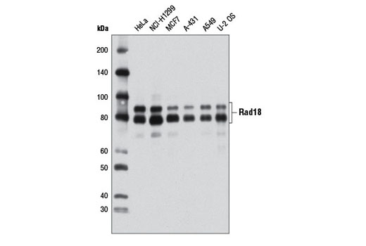 Rad18 (D2B8) XP Rabbit mAb