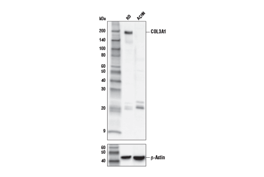 COL3A1 Antibody
