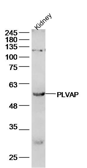 质膜囊泡相关蛋白抗体