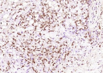 Ki67蛋白单克隆抗体