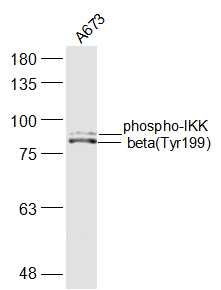 磷酸化KB抑制蛋白激酶b抗体