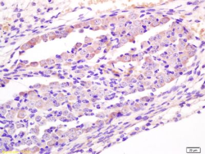 信号通路Wnt1抗体