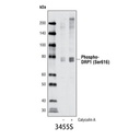 Phospho-DRP1 (Ser616) Antibody