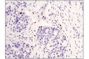 FoxP3 (D2W8E) Rabbit mAb (IHC Specific)