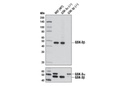 GSK-3 Antibody Sampler Kit