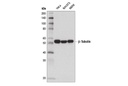 β-Tubulin (D2N5G) Rabbit mAb