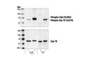 Phospho-Zap-70 (Tyr319)/Syk (Tyr352) Antibody