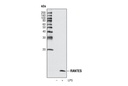 RANTES (R40) Antibody