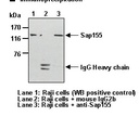 Anti-Sap155 mAb